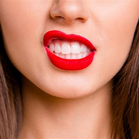 How To Get Perfect Teeth Shape Royal Dental Clinics Blog