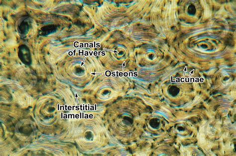 Mammal Compact Osseous Tissue Transverse Section 125X Compact