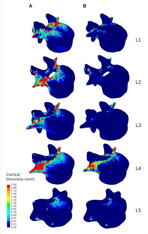 Cortical Thickness Of The Converged Mesoscale Structural Models Of