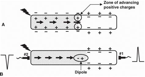 Depolarization Anatomy Definition Anatomy Drawing Diagram 180