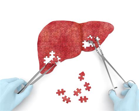 Arrowhead, Takeda's RNA-silencing med cuts scarring in rare liver