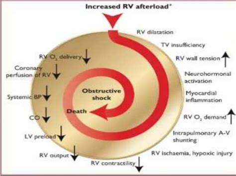 Pe Pptx Pulmonary Embolism Diagnosis And Management Ppt