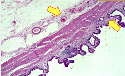 Histologia Parcial Uno Parte I Flashcards Quizlet