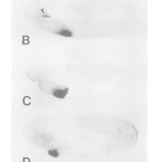 Ectopic Expression Offk H Requires The YPWM Motif And Is Enhanced By