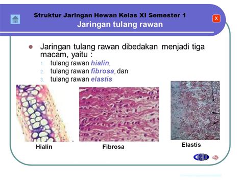 Detail Gambar Jaringan Tulang Rawan Fibrosa Pada Tendon Koleksi Nomer 21