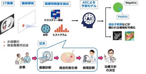 人工知能の放射線医療への応用 山口大学医学物理研究推進体