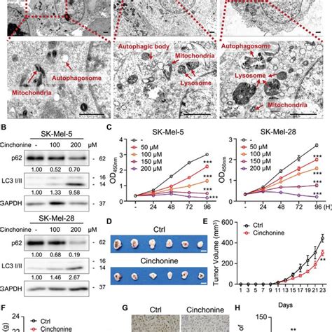 Cinchonine Promotes The Apoptosis Of Melanoma Cells A And B