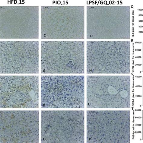 Immunohistochemical Analysis For Interleukin 6 IL 6 Inducible Nitric