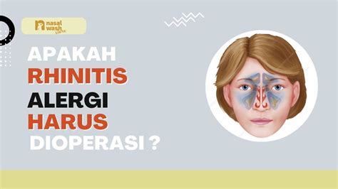 Apakah Rhinitis Harus Dioperasi YouTube