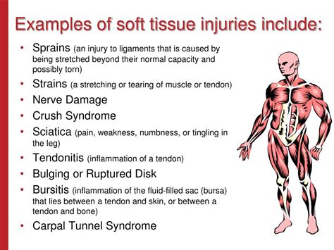 Ppt Soft Tissue Injury Prevention Safety Stand Down June