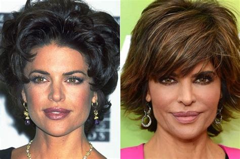 Lisa Rinna plastic surgery and silicone lips made her famous