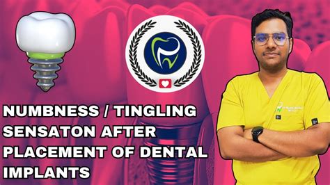 Dr Rudra Mohan Neurosensory Disturbances After Dental Implant