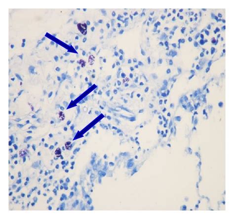 Toluidine Blue Staining For Mast Cell Analysis A Control Group No