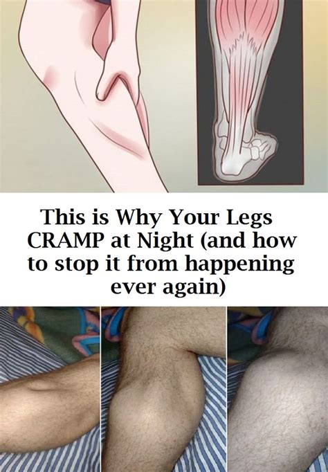 This Is Why Your Legs Cramp At Night And How To Stop It From Happening