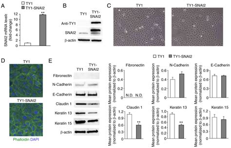 SNAI2 is induced by transforming growth factorβ1 but is not essential