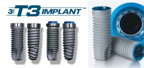 Implant Systems Bangkok Dental Implant