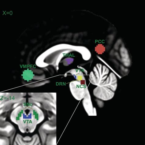 Anatomical Location Of Ventromedial Prefrontal Cortex Vmpfc Thalamus