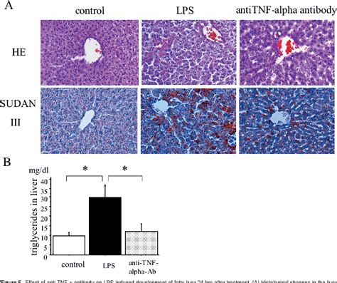 Figure 5 from TNF α Induces Hepatic Steatosis in Mice by Enhancing Gene