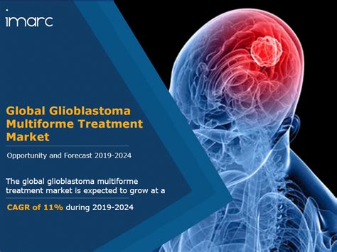 Glioblastoma Multiforme Treatment Market and Forecast 2019-2024