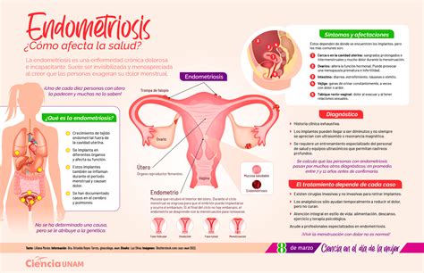 Endometrio Fuera De Lugar La Influencia De Las Hormonas En La