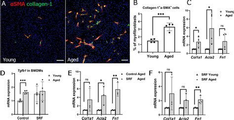 Expression Of Fibrotic Markers In Bone Marrow Derived Macrophages