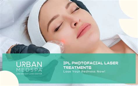 Ipl Photofacial Laser Treatments Lose Your Redness Now Urban Medspa