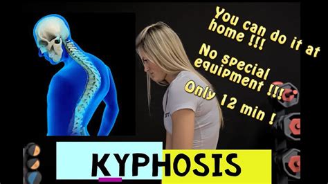 How To Fix Your Posture In Moves Kyphosis Daily Exercise Routine