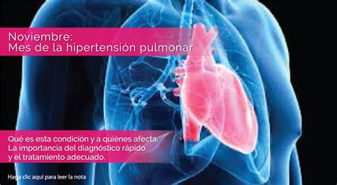 Noviembre Mes De La Hipertensión Pulmonar Wikicardio