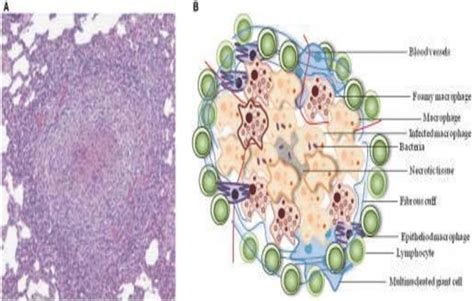 Representative Architecture Of A Tb Granuloma A A Representative Download Scientific Diagram