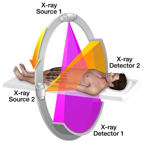 Ct Scan Labelled Diagram