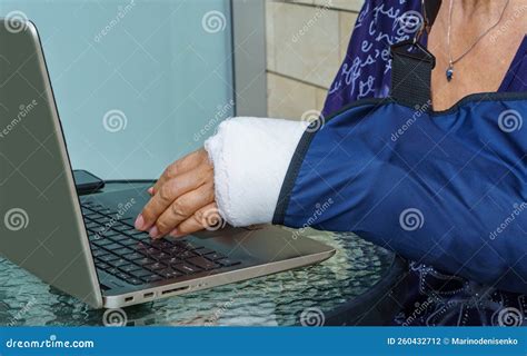 Broken Arm With Plaster Cast In Wearing Bandage To Support Injured Arm