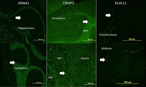 Unique Indirect Immunofluorescence Assay On Mouse Brain With Antihuman