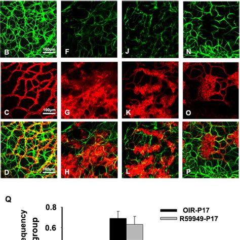 R59949 reduce neovascular tuft formation of retinal vessels in OIR ...