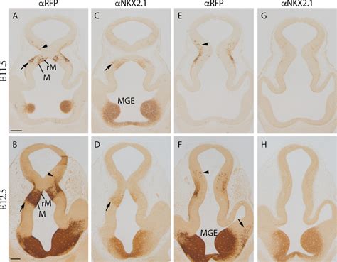 Frontal sections of Nkx2.1cre/+; tdTomatoflox/+embryos following the ... 