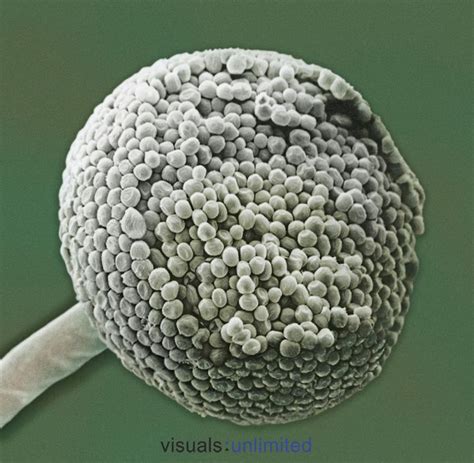 Spores on the sporangium of the common bread mold Rhizopus. SEM X700 ...