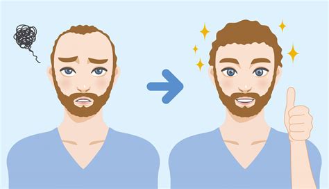 Benefits Of Fue Hair Transplant Zayn Skin Hair Clinic In Pune