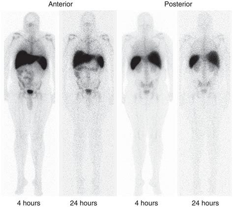 Infection Inflammation Imaging Radiology Key