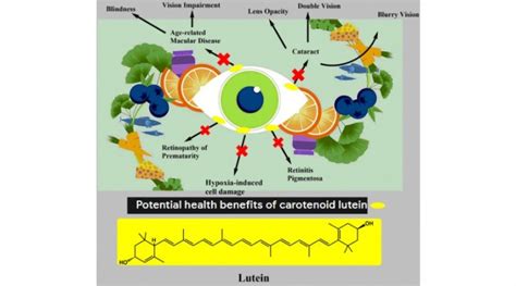 Potential Health Benefits Of Carotenoid Lutein Obn