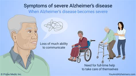 Slide Show Understanding Alzheimers Disease