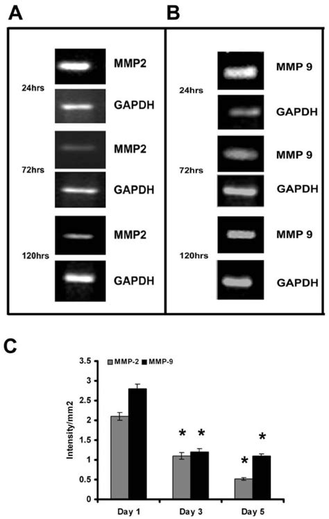 Expression Of Mmp And Mmp In Huvecs Rt Pcr Cells Were Maintained