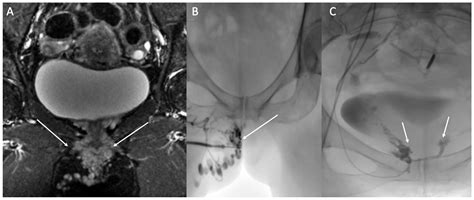 Diagnostics Free Full Text Diagnosis And Management Of Pelvic