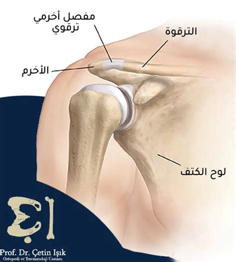 تمزق الأربطة؛ أنواعه وكيفية التعامل معه د شتين اشيك