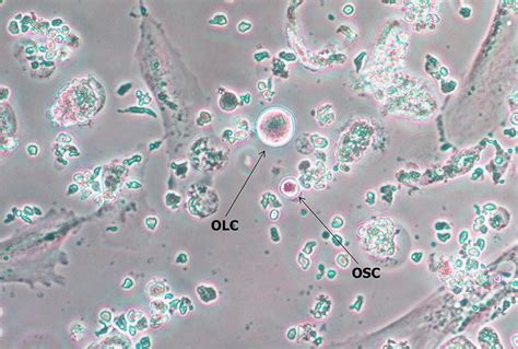 In Vitro Differentiation Of Ovarian Stem Cells Oscs To Oocyte Like