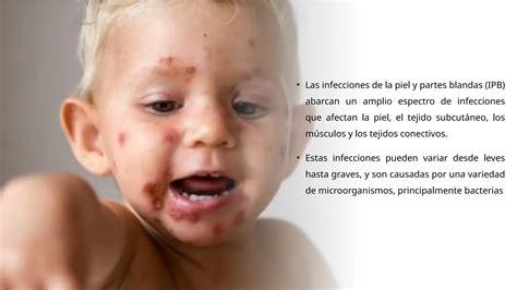 Infecciones De La Piel Y Partes Blandas Pptx