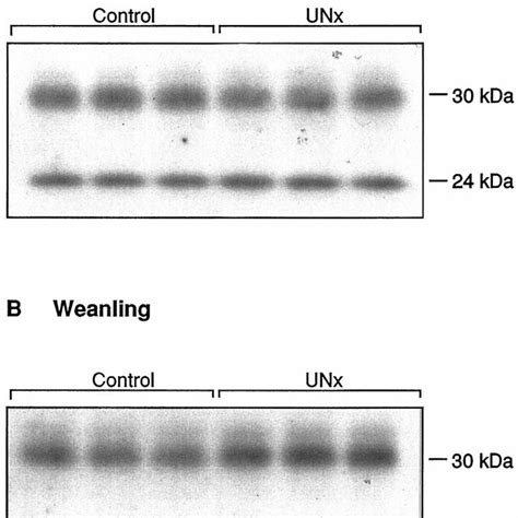 Western ligand blot of plasma membrane-associated insulinlike growth ... 