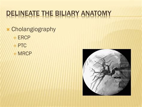 Ppt Classification And Management Of Bile Duct Injury Powerpoint