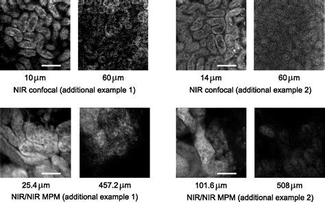 All Near Infrared Multiphoton Microscopy Interrogates Intact Tissues At