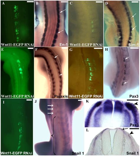 Decrease Of Dermal Markers After Wnt11 RNAi A Embryo Showing The