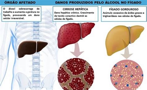 Efeitos Nocivos Do Lcool No Organismo Melhor Sa De