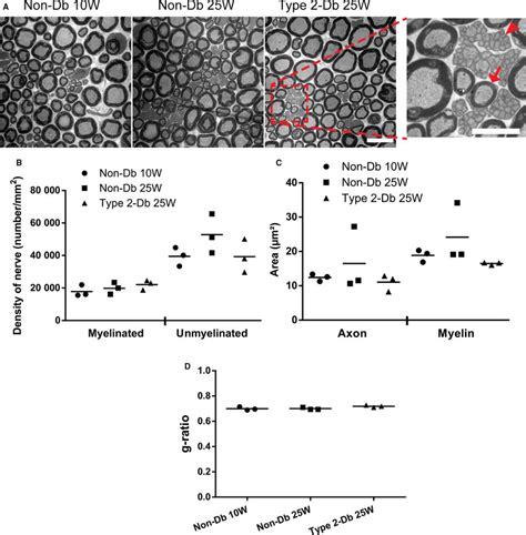 Morphometric analysis of sciatic nerve trunk by electron microscopy ... 